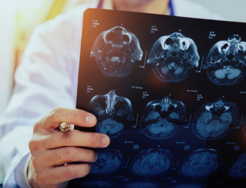 Alcohol Consumption and Alzheimer’s Disease: What You Need to Know